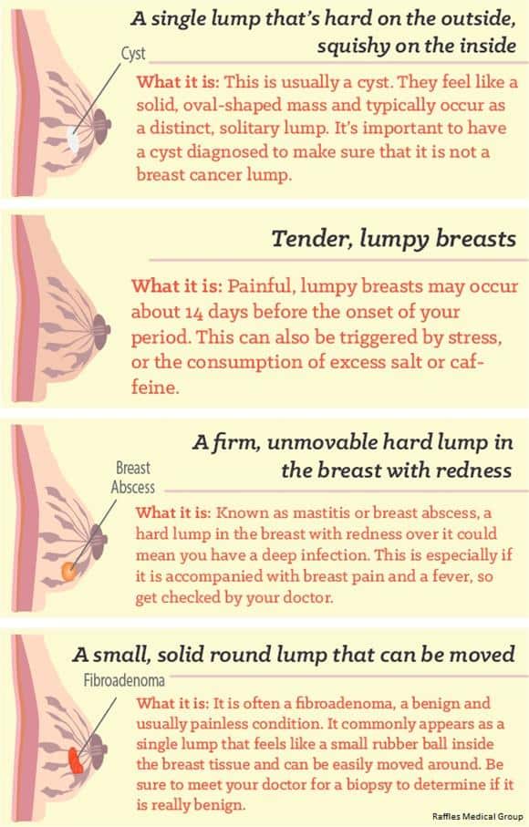 Decoding Lumps & Bumps » Raffles Medical Group