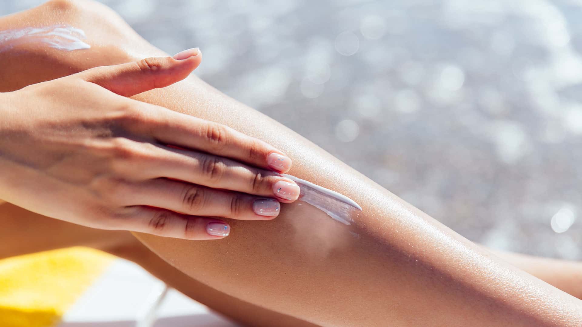 Use of sunscreen on the affected area - vitiligo