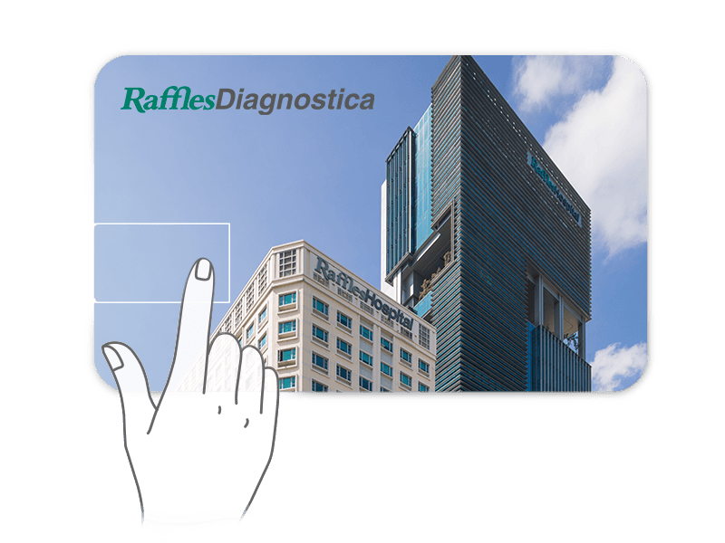 Raffles Diagnostica DCIM card type, push and flip the USB connect out